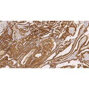 Galectin-3